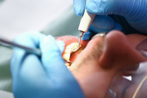 Best Emergency Dental Extractions in Rankin, TX