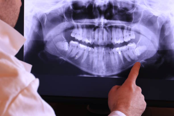Best Emergency Dental Services for Seniors in Rankin, TX